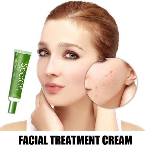Face Cream Acne Treatment Moisture Against Scar Removal Control Oil Repair Skin Restore Smooth Face Deep Moisturizing TSLM1