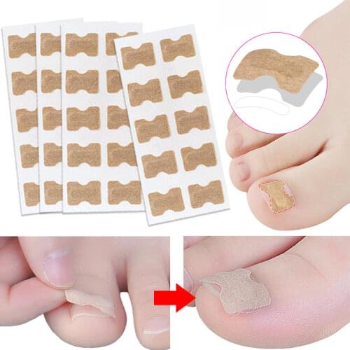 Toe Nail Corrector Sticker Paronychia Treatment Fixer Recover Elastic Patch Pedicure Foot Toe Ingrown Care Tools Glue Free