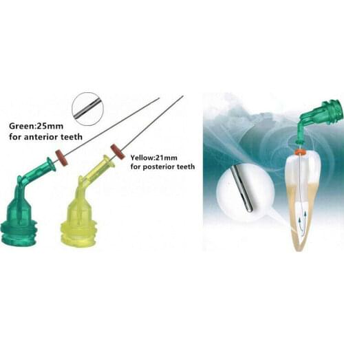 Dental EDTA Irrigation Needle Ultradent NaviTip Disposable Syringe Tips 30G Autoclavable 2-Side Hole Yellow-21mm/Green-25mm