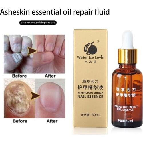 New 30ml Fungal Nail Treatment Essence Oil Feet Care Nail Polish Tools Nail Gel Armor Essence Toe Nail Fungus Removal