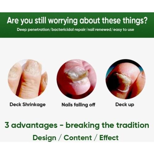 30ml Fungal Nail Repair Essence Serum Care Treatment Gel Anti Fungus Removal Foot Paronychia Infection Onychomycosis Nail E9V6