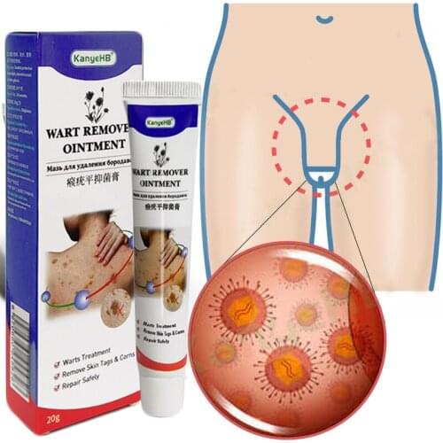 1PC Wart Remover Ointment Genital Herpes Genital Vulva Condyloma Acuminatum Skin Tag Remover Antibacterial Treatment Cream