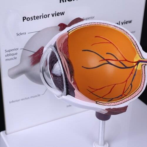 Human Right Eye Eyeball Model Cross Section Anatomical Glaucoma Display Instrument Study Teaching Tool