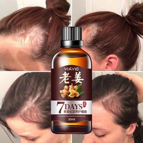Fertilizer For Hair Fast Hair Growth Dense Regrowth Ginger Serum Oil Anti Loss Treatment Essence Bin Head Fertilizer Women Men