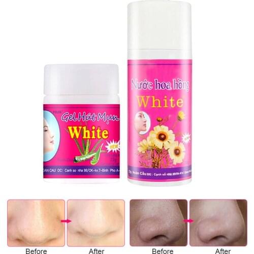 Nose Mask Blackhead Remover Shrink Pores Treatment Black Deep Cleansing Skin Care Cream Nose Moisturizing Whitening TSLM2