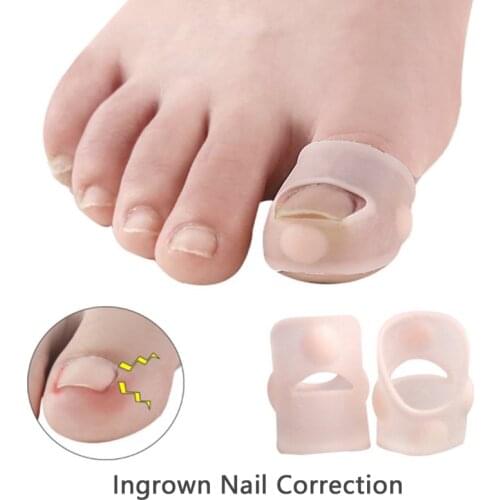 1pcs Invisible Ingrown Toe Nail Treatment Elastic Straightening Clip Brace Silicone Ingrown Toenail Correction Tool