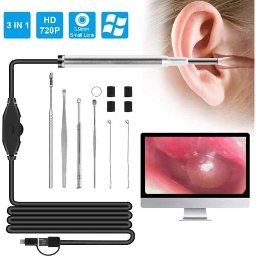 5.5MM Smart Otoscope USB Ear Endoscope Video Camera Professional Examination Earwax Removal Cleaning Kit Tool for Checking Ears