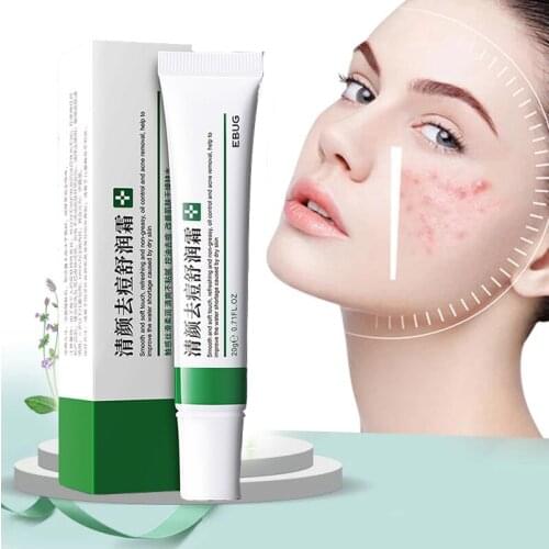 1/3pcs Effective anti-acne cream Anti-freckle cream Fades acne spots Oil control Shrink pores Whitening moisturizing skin care