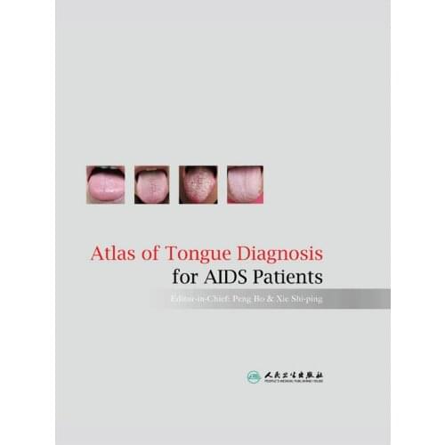 Atlas of Tongue Diagnosis for AIDS Patients. TCM. Hardcover 9787117080422