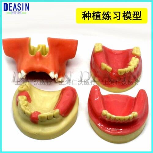 High Quality Implant practice model for teaching dental tooth teeth dentist anatomical anatomy model odontologia