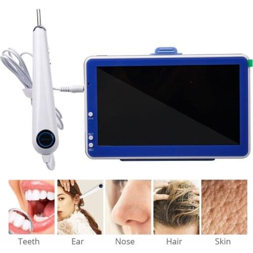 7-inch High-definition Visual Otoscope ENT Endoscope Visual Ear Picking Artifact Nasal Cavity Oral Ear Canal Endoscope Ear Check