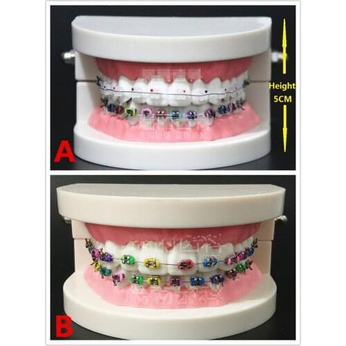 1PC Dental Orthodontic Treatment teeth Model with Ortho Metal Bracket Arch Wire Buccal Tube Ligature Ties & ceramic brackets