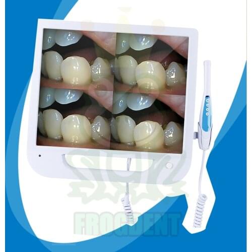 Medical Equipment Digital Dental Intraoral Camera with Monitor 17 Inch Screen Oral Camera Endoscope 5.0 Mega Pixels