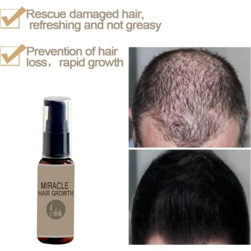 60ml miracle hair care essential oil conditioner ginger hair growth essential oil Morocco Nourishes hair Hairdressing