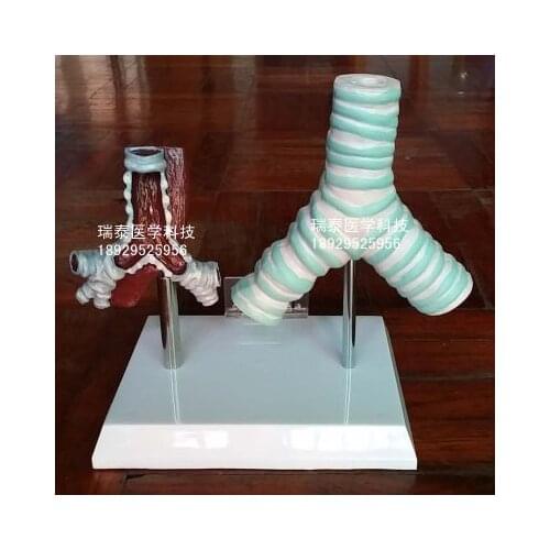 Lung model Smoking harms health The popular science model