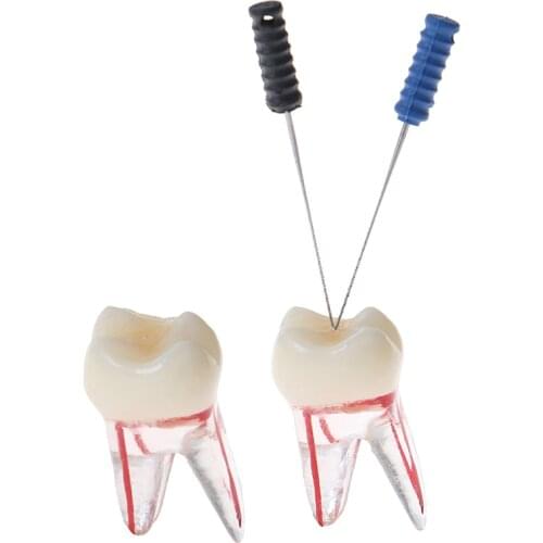1:1 Resin Dental Endodontic Student Study Practice Model With Colored Root Canal And Pulp Transparent Without Files New Arriva