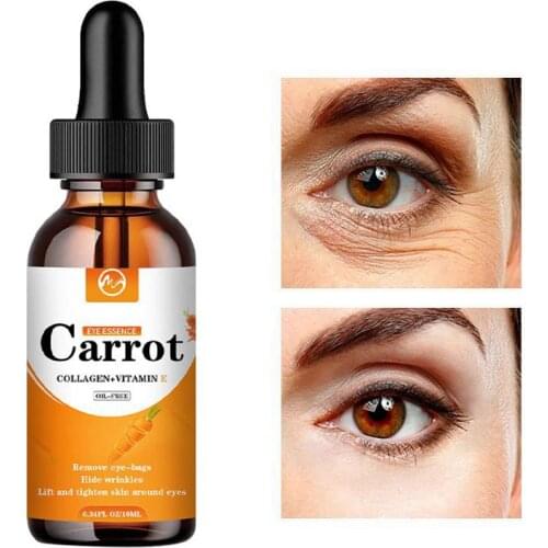 Minch Anti-wrinkles Carrot Eye Serum Remove Eye Bags Blemish Anti Puffiness Dark Circles Delays Deep Hydration Essence Eye Cream