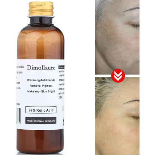 Dimollaure 30g pure 99% Kojic Acid whitening cream Wrinkle removal Freckle melasma Acne scar pigment age spot melanin sunburn