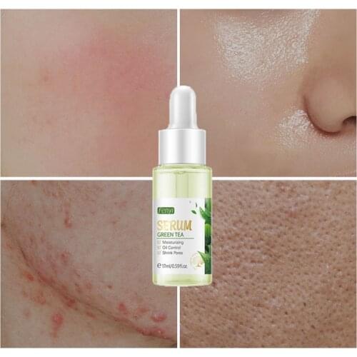 SZYDIT Revitalizing Face Serums