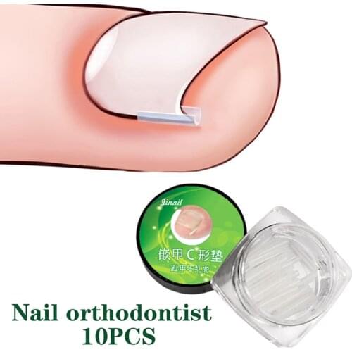 10PCS Ingrown Pads Nail Corrector Nail Correction Devices Correction Treatments Sticker Patch Relief Pain Foot Care Tools