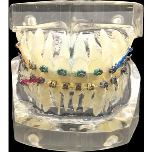 1PC Dental Orthodontic Study Teaching Model Teeth Orthodontic With Colorful Brackets for Neat and misaligned models choose
