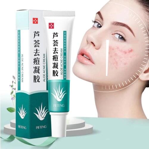Effective Acne Remover Cream Acne Treatment Fade Acne Spots Oil Control Shrink Pores Whitening Moisturizing Acne Cream Skin Care