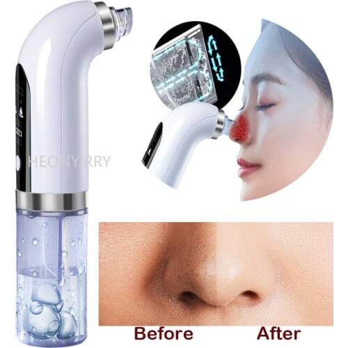 Electric Small Bubble Blackhead Remover USB Rechargeable Water Cycle Pore Acne Pimple Removal Vacuum Suction Facial Cleaner Tool