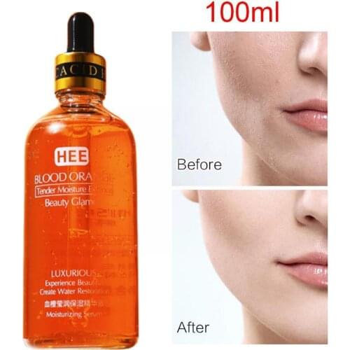 Blood Orange Moisture Essence Hyaluronic Acid Serum Anti-wrinkle Liquid Essence Anti-oxidation Skins Nicotinamide Care Smoo U1G2