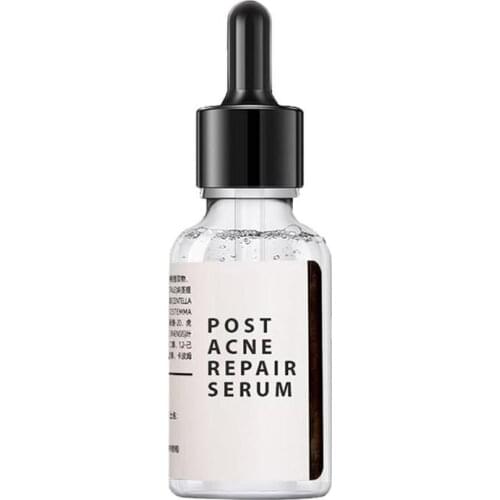 Whitening Spot Essence Solution Removes Acne Face serum Shrinks Pore Moisturizing Essence Fade Spot Brighten Face Skin Care