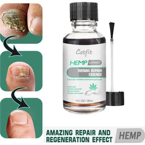 Catfit Nail Treatment Feet Care Essence Nail Foot Whitening Toe Nail Fungus Removal Gel Anti Infection Paronychia Onychomy