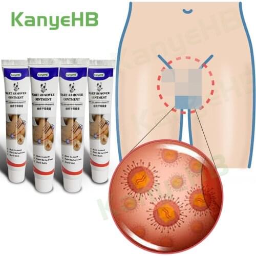 4pcs Genital Wart Remover Ointmen Vulva Condyloma Antibacterial Treatment Cream For Male & Female Papilloma Warts Skin Tag A636