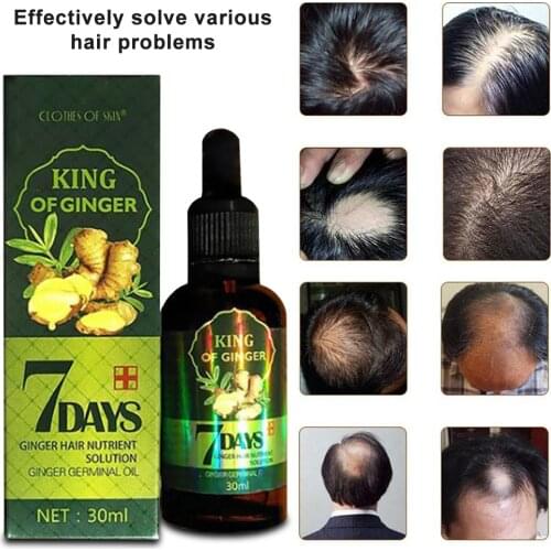 NEW Hair Growth Essence liquid Fast Hair Growth Ginger Extract Anti Hair Loss