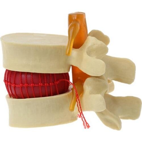 Lumbar Vertebrae Model Anatomical Spine Lumbar Disc Herniation Anatomy Teaching Tool Lumbar Vertebrae Model