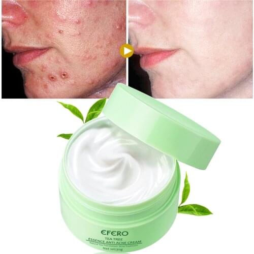 Tea Tree Anti Acne Treatment Face Cream Whitening Moisturizing Cream Shrink Pores Oil Control Anti Aging Blackhead Acne Removal