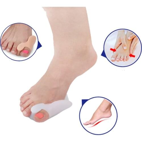 1 pairs Hot saleHallux valgus correction daily spot a large number of wholesale appliance care insole insole toe Free shipping