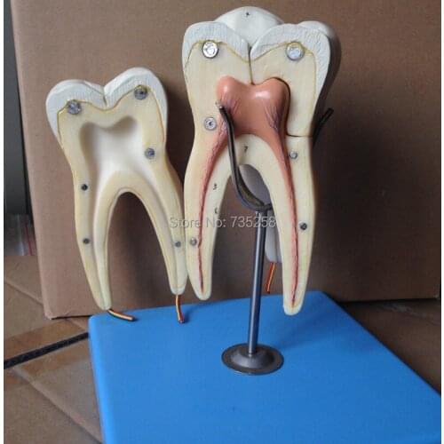 Three Model of Mandibular Molar Root,Teeth Model,Molar Model,Mandibular Molar Model