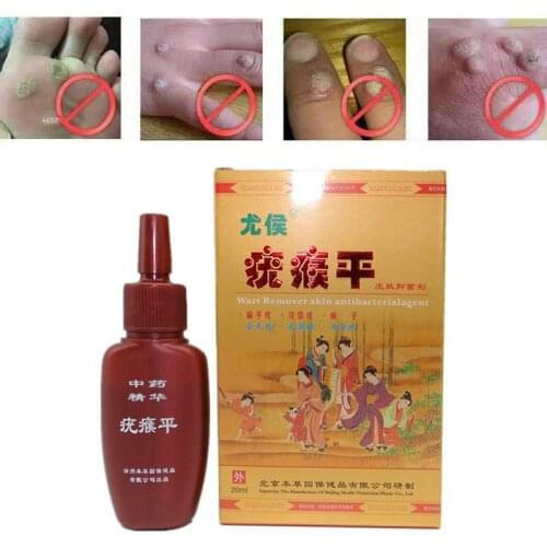 Skin Tag Remover Genital Wart Treatment Removal Mole & Papillomas Foot Corn Medical Repair Natural Bacteriostatic Liquid TSLM1