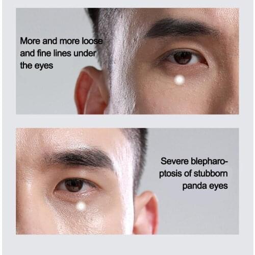 20g Eye Cream Anti Anti-aging Remover Dark Circles Eye Eye Swelling Cream Beauty Eye Massage Men Serum Care N7L3