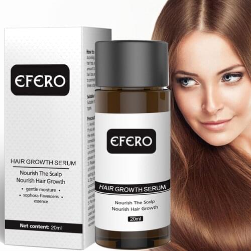 EFERO 20ml Hair Growth Essence Prevent Hair Loss Treatment Ginger Grow Hair Serum Dense Gentle Hair Growth Serum Health Care