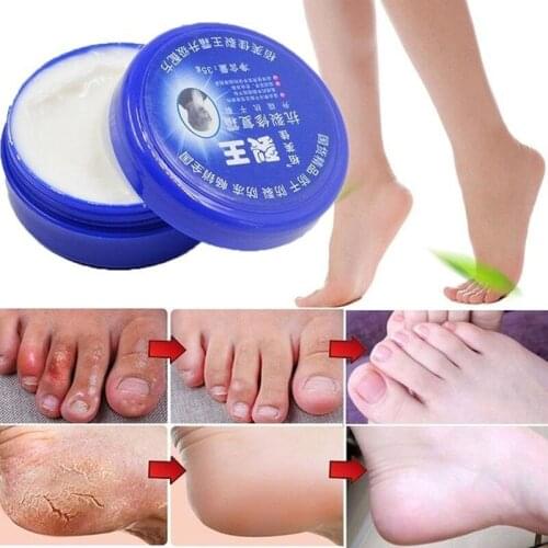 Anti Dry Crack Skin Care Traditional Chinese Balm Exfoliating Hand Foot Crack Cream Heel Chapped Peeling Feet Hand Repair
