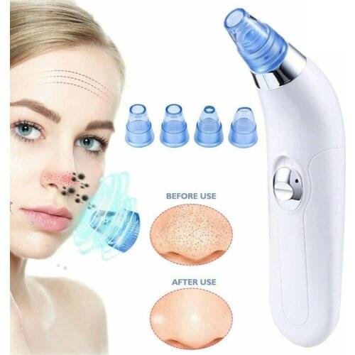 Pro Blackhead Remover Vacuum Suction Nose Facial Pore Cleaner Spot Acne Black Head Pimple Remover Beauty Face Skin Care Tool