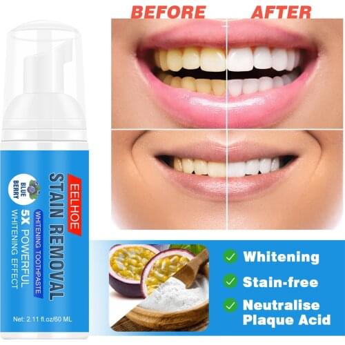 60ml Teeth Whitening Serum Dental Oral Hygiene Effective Remove Stains Plaque Teeth Cleaning Essence Dental Care Toothpaste