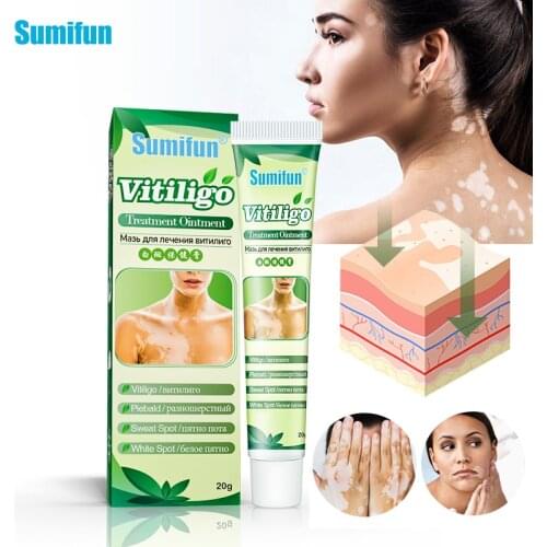 1Pc White Spot Ointment Antibacterial Cream Localized Mycosis Leukoplakia Plaster Vitiligo Treatment Antibacterial Oil Skin Care