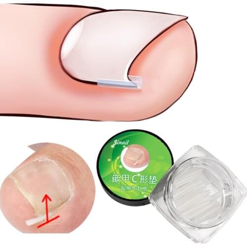 10PCS Ingrown Nail Pad Ortho Nail Filling Nail Groove Pad Professional Embedded Toe Nail Corrector Toenail Care Pedicure