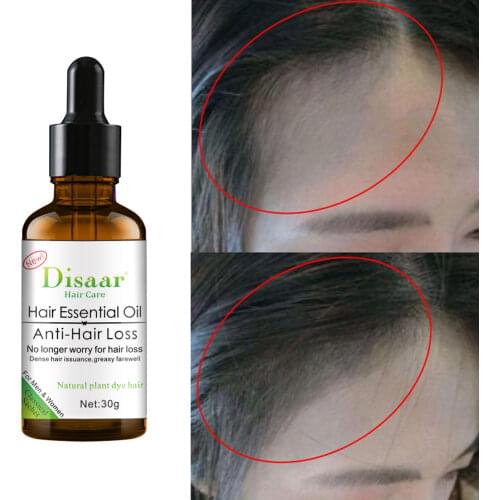 Hair Essential Oil Anti-Hair Loss Promoting Hair Growth Oil Repair Damage Hair Improve Hair Loss Nourishing Hair Root Care 30ml