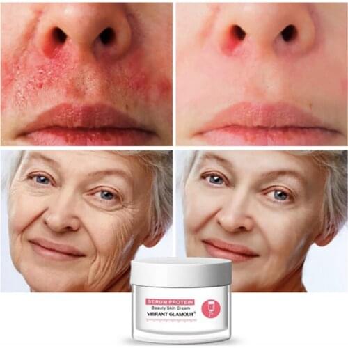 Serum Ptorein Melasma Treatment Anti Aging Cicatrices Eliminar Face Creams For Women Dark Spot Remover Creme Clareador Para Acne