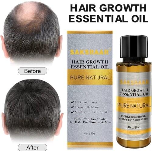 Ginger Hair Care Oil To Prevent Hair Loss And Baldness Hair Care Nourish And Repair Hair Root Liquid Hair Care Essential Oil