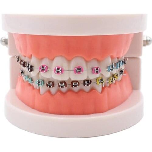 Teeth Whitening Dental Orthodontic Treatment Metal Bracket Study Implant Model Molar Tube Dentistry Dentist Tool Lab Equipment