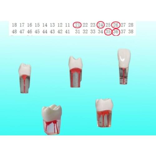 5 Pieces/Set Endodontic Practice Teeth Model for RCT Transparent Resin with Dyed Root Canal