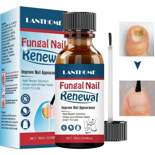 LANTHOME Fungal Nail Renewal Anti Fungus Nails Solution Clean Whiten Nail Nourish Revive Nail Discolorations Regenerate Toe Nail